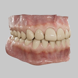 teeth_shareSSS_1-300.jpg